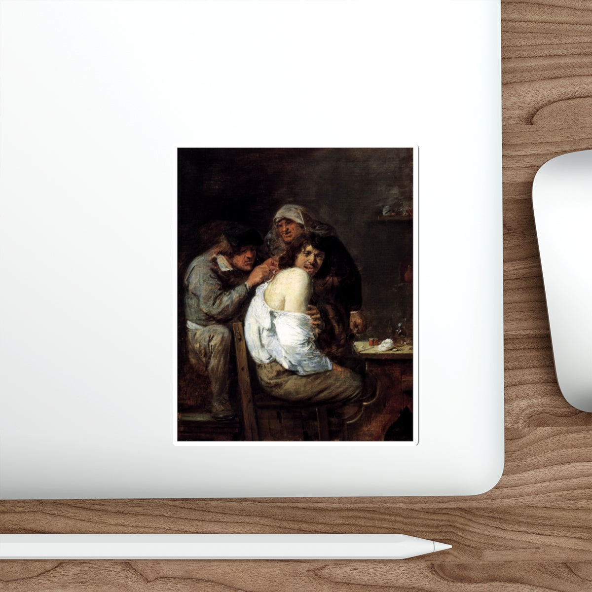 BROUWER, Adriaen - The Back Operation (Artwork) STICKER Vinyl Die-Cut Decal-The Sticker Space