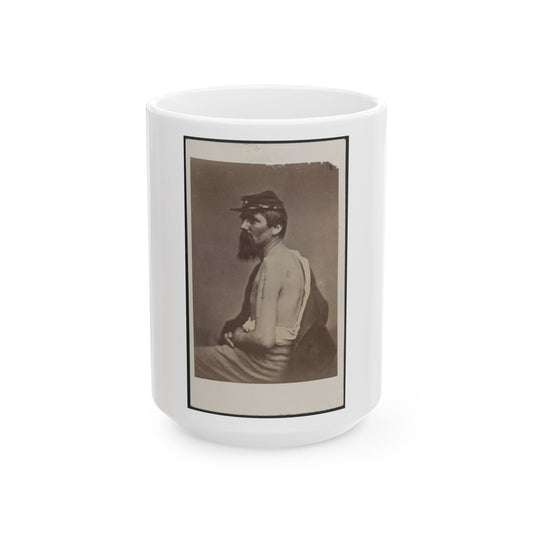 Soldier Named Ewing In Kepi Displaying A Wound To His Arm (U.S. Civil War) White Coffee Mug-15oz-The Sticker Space