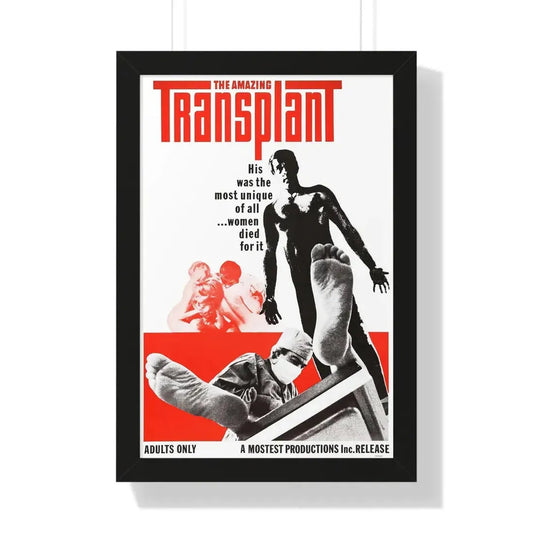 THE AMAZING TRANSPLANT 1970 - Framed Movie Poster 16″ x 24″ Black - The Sticker Space